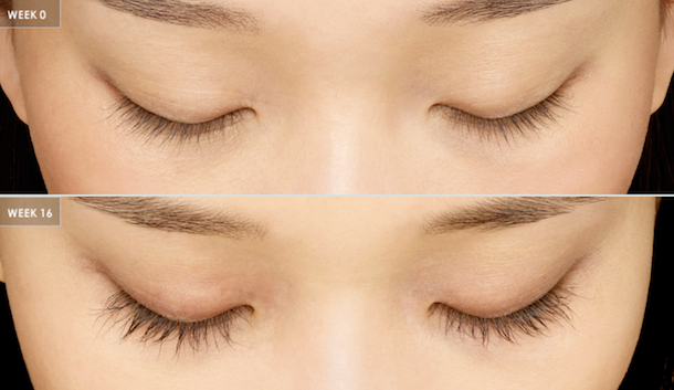 Latisse for Full and Long Eyelashes in Delaware