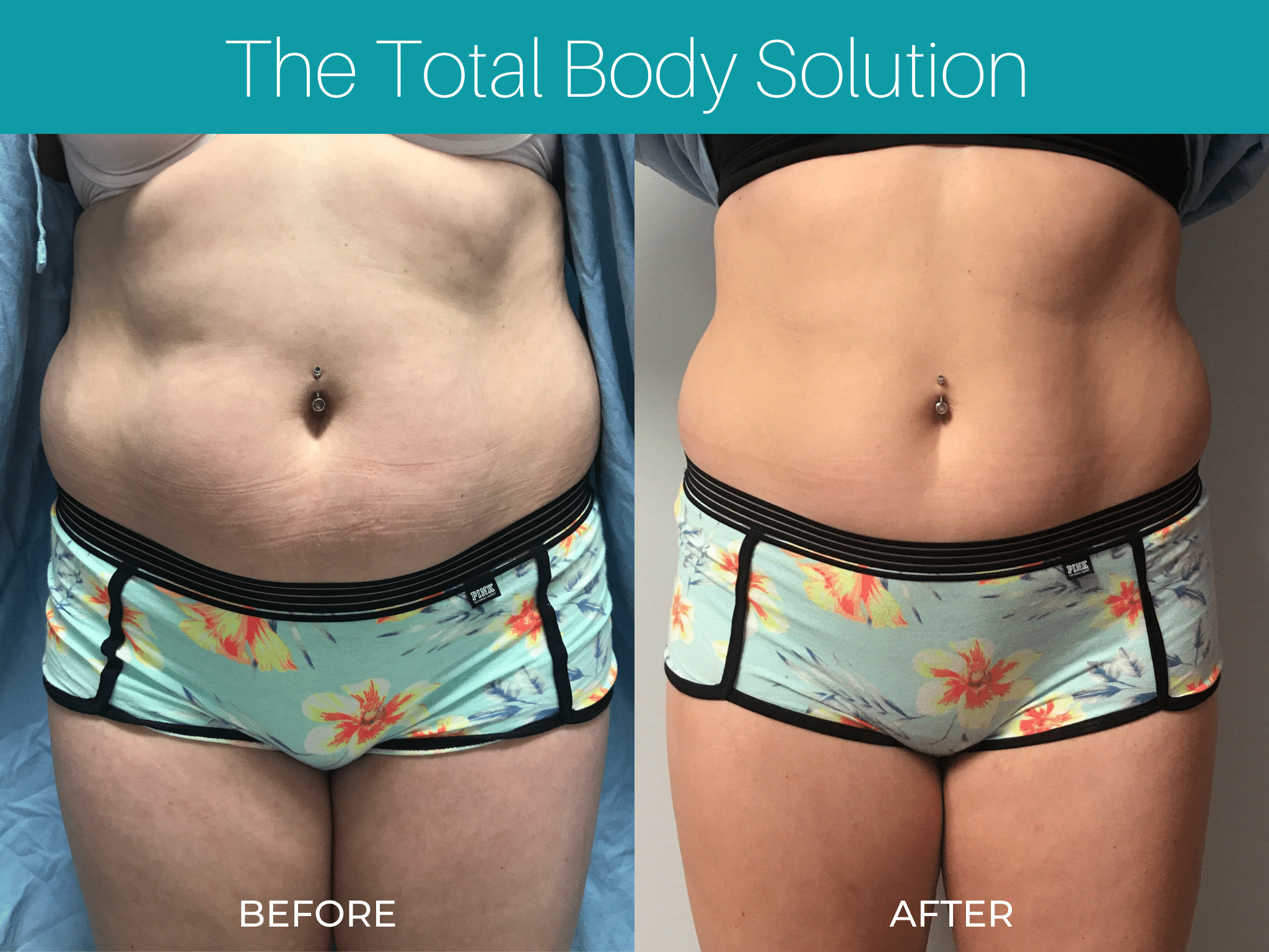 The Total Body Solution