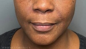 After Image: Facial Rejuvenation & Balancing